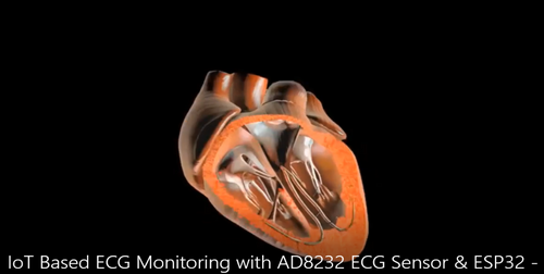 IoT Based ECG Monitoring with AD8232 ECG Sensor & ESP32